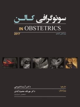 سونوگرافی کالن IN Obstetrics 2017